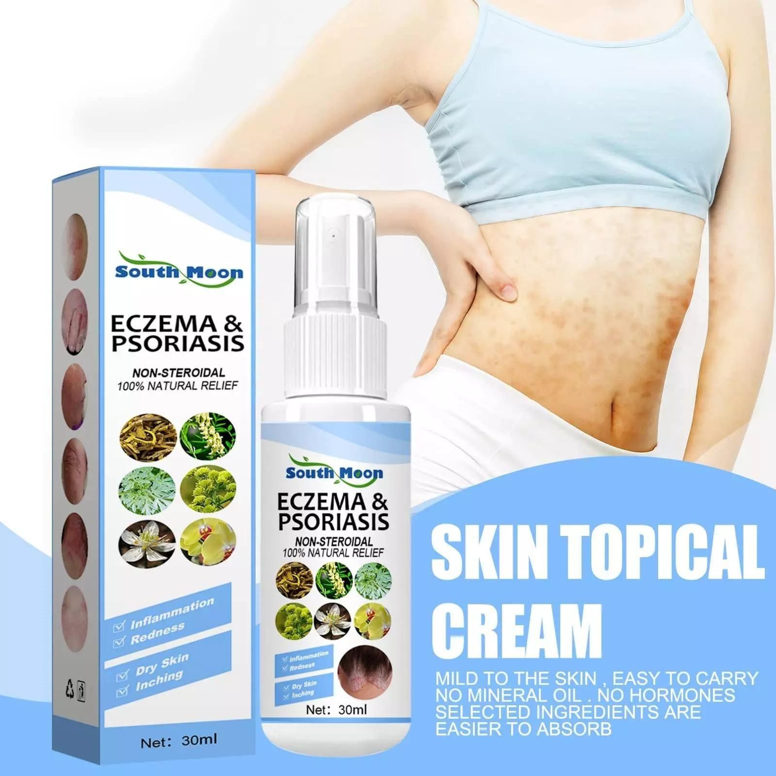 Herbal Psoriasis Relief Spray - AmazingBaba