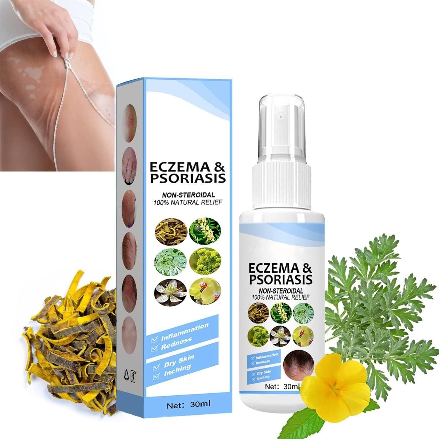 Herbal Psoriasis Relief Spray - AmazingBaba
