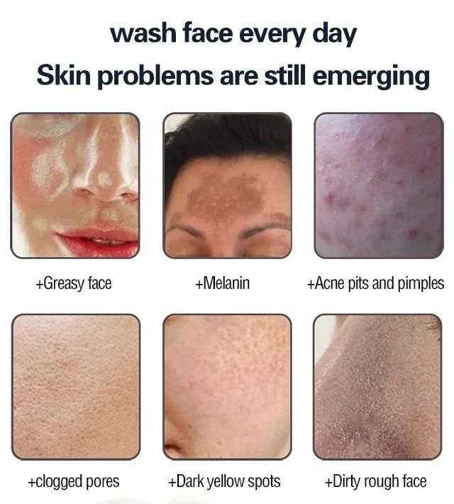 Blackthorn Skin Cleanser(Pack Of 2) - AmazingBaba