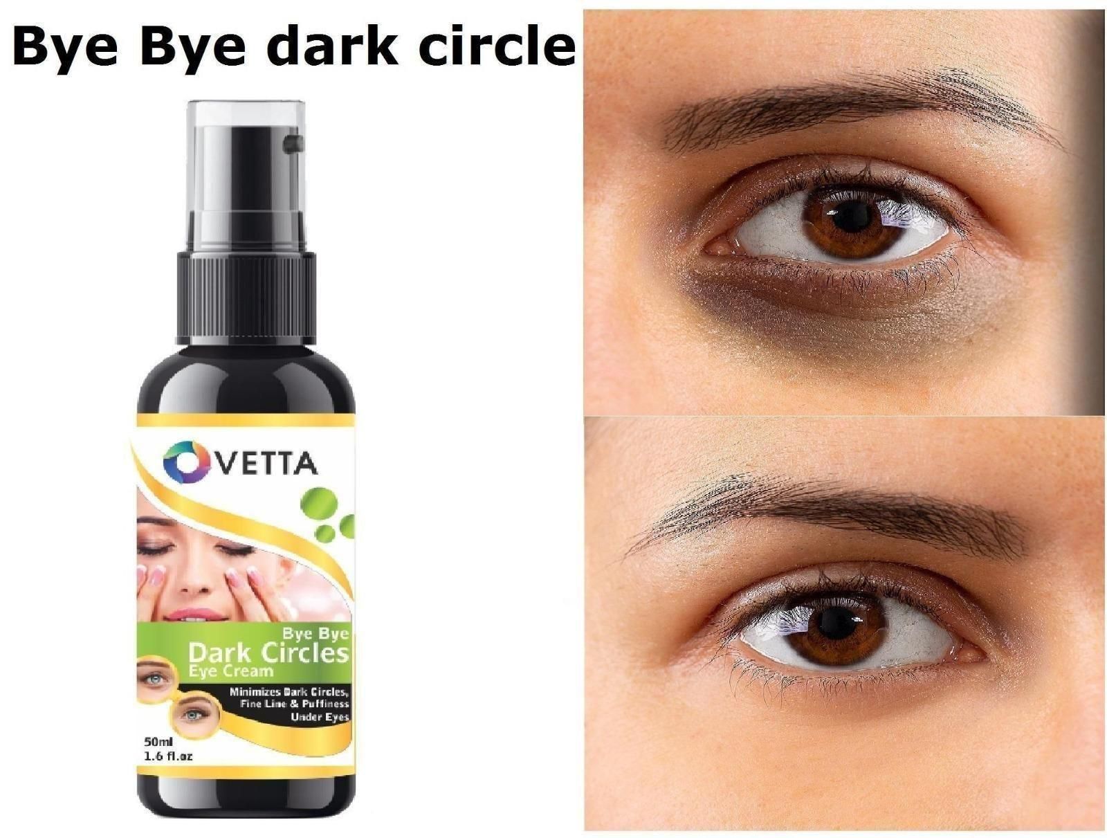 Ovetta Dark Circles Eye Cream - AmazingBaba